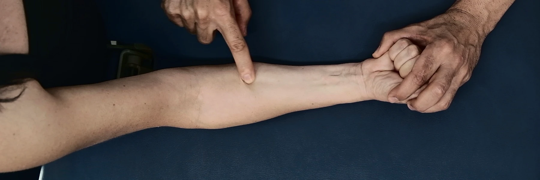 Las manos de Daniel Torres señalando el flexor radial del carpo sobre el antebrazo de una paciente
